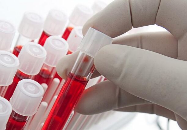 vereanalüüs pärast alkoholi joomist